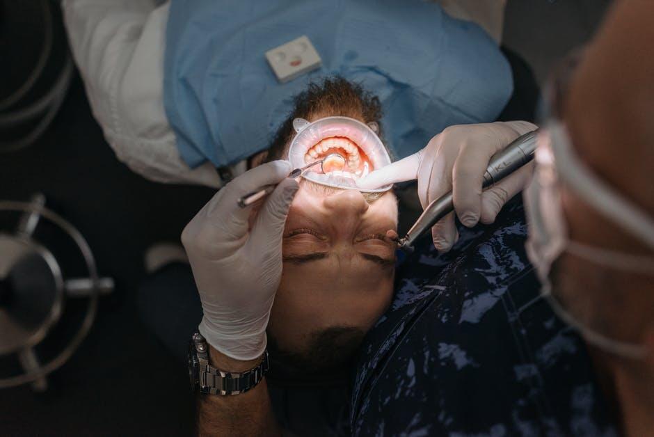 A person lying on an operating table having their wisdom teeth removed.
