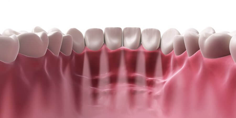 Dentalalveolar surgery, remodeling gums, exposure of unerupted teeth, apicectomy, inferior dental nerve.