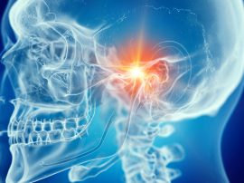TMJ (temporomandibular joint) dysfunction in brisbane